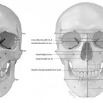 Craniometric frontal points and measurements