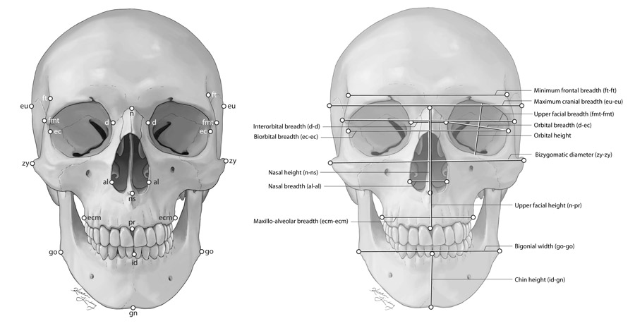 Craniometric frontal points and measurements